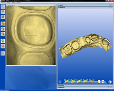 CEREC software expertise is the key to cerec ROI
